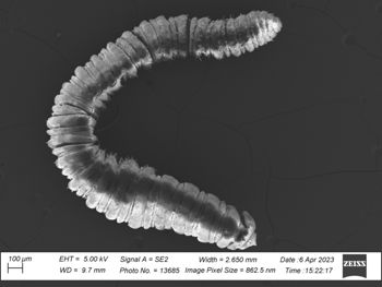 Media type: image;   Invertebrate Zoology 32029 Description: SEM image of specimen.;
